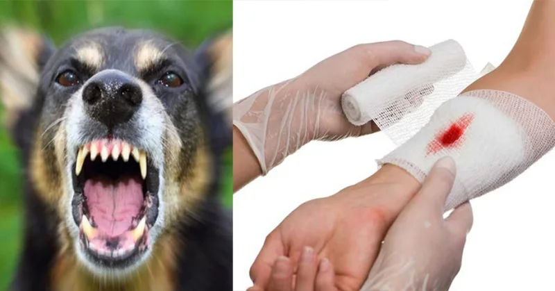 mơ thấy chó cắn là điềm gì
